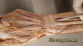 Extensor Retinaculum of the HandWrist [upl. by Amlev]