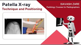 How to perform Patella Xray procedure Tangential sunrise view [upl. by Etheline287]