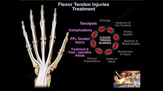 Flexor Tendon Injuries Treatment  Everything You Need To Know  Dr Nabil Ebraheim [upl. by Dyal]