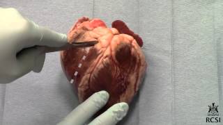 Sheeps Heart Dissection [upl. by Ad]