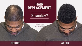 Full Head of Hair FAST  Xtrands Hair Replacement System [upl. by Quenby]